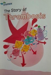 THE STORY OF THROMBOSIS