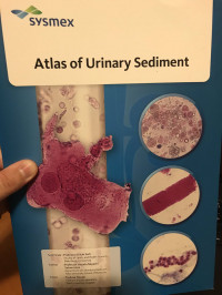 ATLAS OF URINARY SEDIMENT