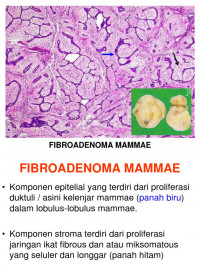 CATATAN KULIAH; PATOLOGI MAMMAE